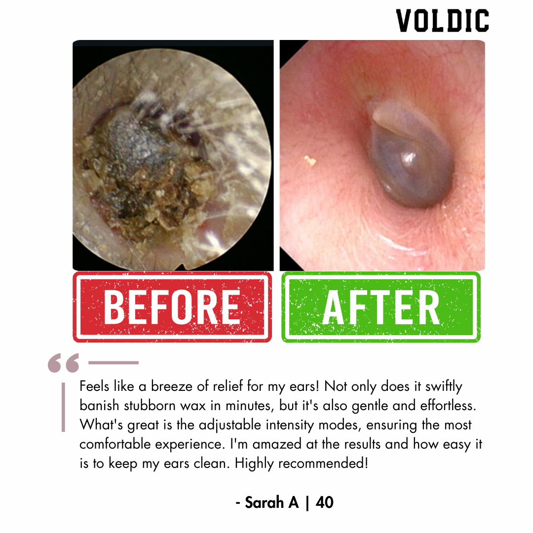Electric Ear Wax Removal Kit