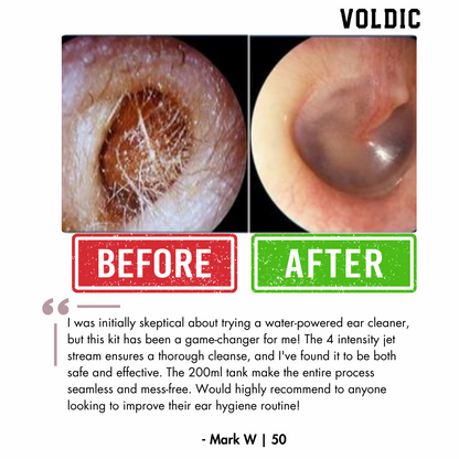 Electric Ear Wax Removal Kit