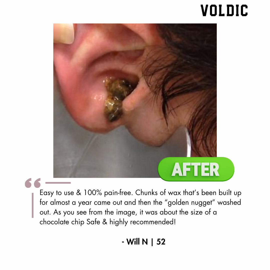 Electric Ear Wax Removal Kit