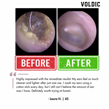 Electric Ear Wax Removal Kit